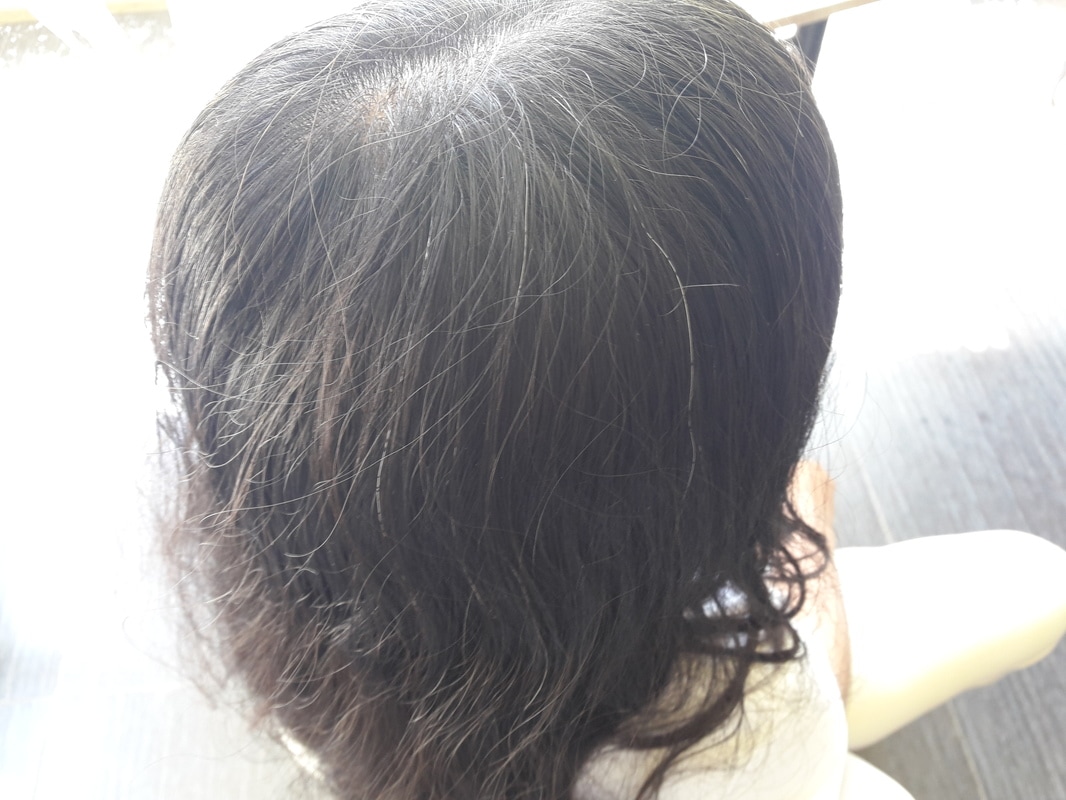 White Hairs On Kids And Teens - Earthwaters